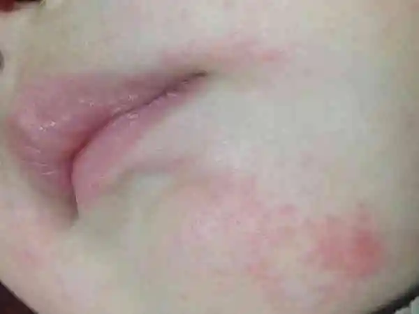 宝宝鼻子不通气怎么办