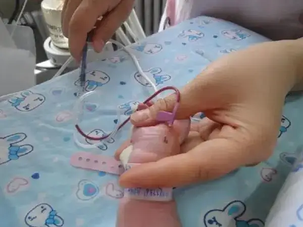 宝宝生理性和病理性黄疸的区别是什么