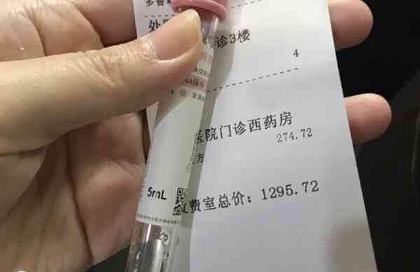 唐筛过不了的原因有哪些