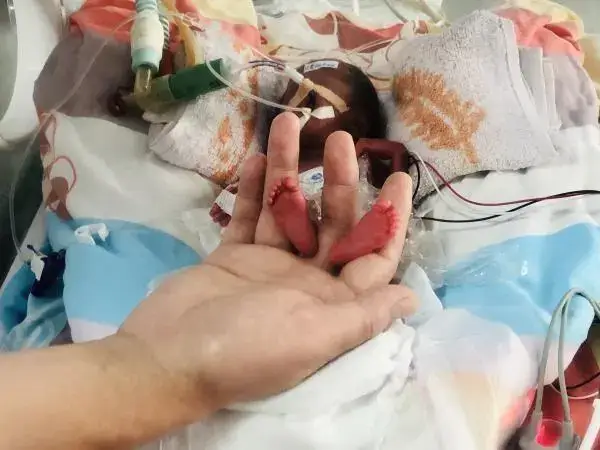 早产儿出院后在家如何护理
