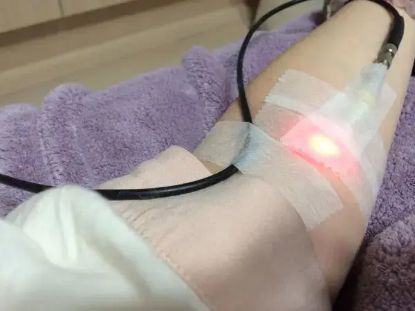 重度地中海贫血的症状有哪些