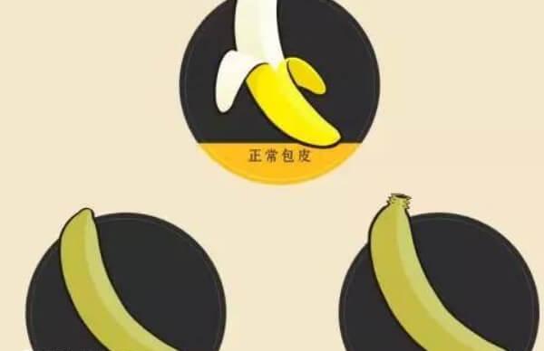 小儿包茎手术最佳年龄是多少岁