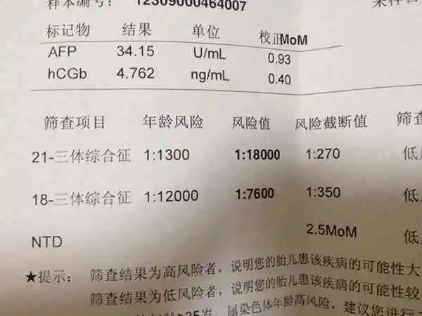 唐筛几周做是最佳时间