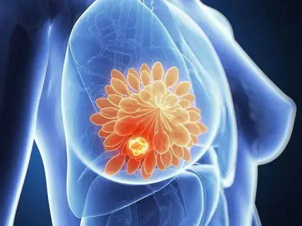 乳腺增生和乳腺结节有什么区别