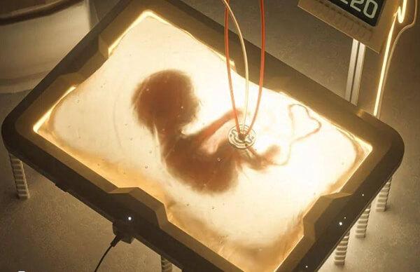 石女能不能做试管婴儿