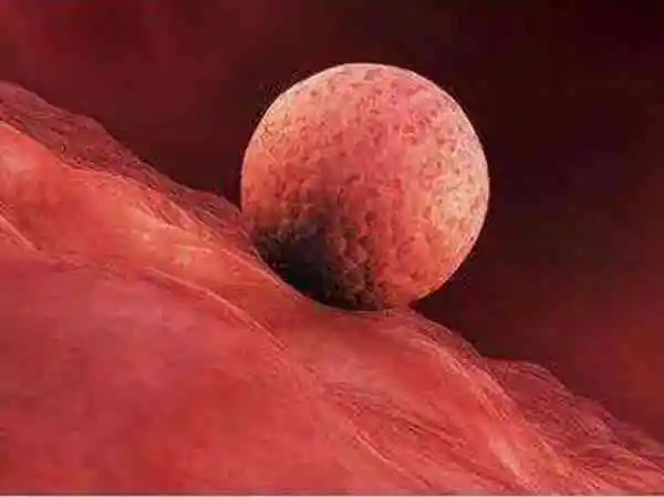 试管婴儿移植第7天出血的原因是什么