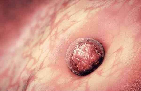 子宫内膜活跃对胚胎着床好不好