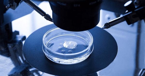 二代试管婴儿技术优劣势有哪些