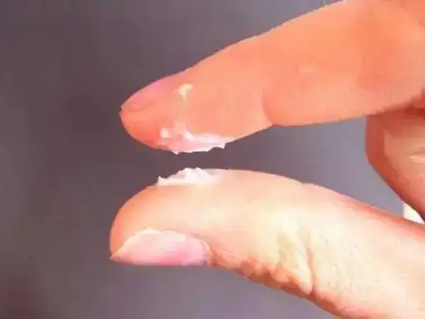 白带像浆糊一样是什么原因