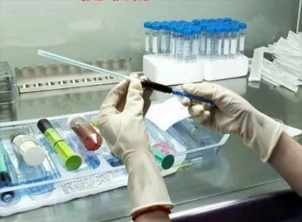 试管婴儿宫腔灌注费用是多少