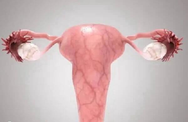 子宫内膜异位症对女性有哪些危害