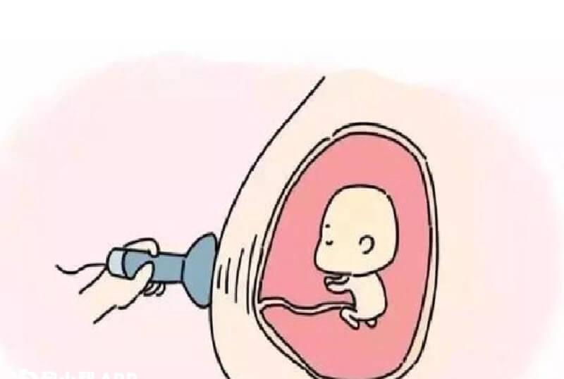 nt值为4.2mm风险有多大