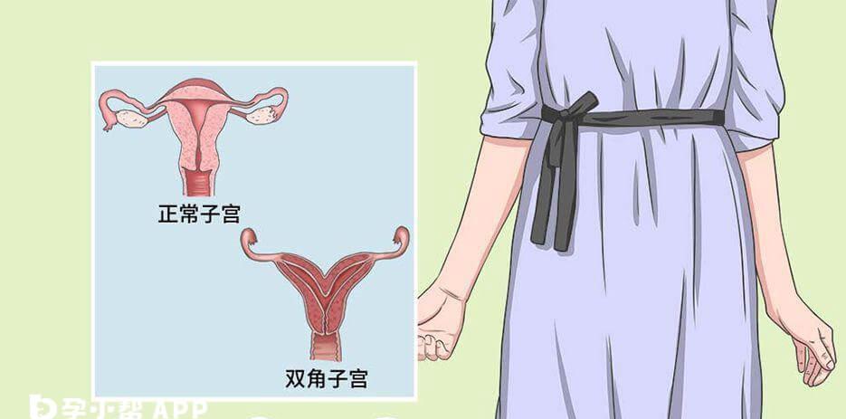 双角子宫做试管成功率多少