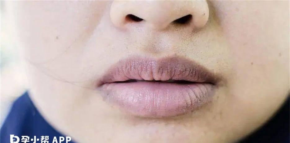 女人嘴唇发紫发黑怎么调理
