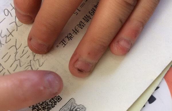 12岁儿童心理有问题的表现有哪些