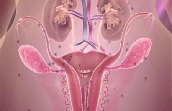 子宫肌瘤能否做试管婴儿
