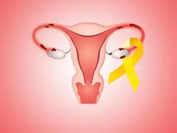子宫腺肌症患者如何成功怀孕