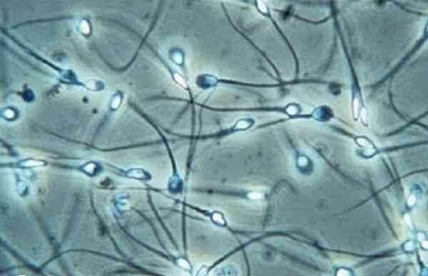 精子畸形能否怀孕生育