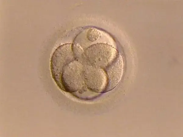 囊胚只移植一个的原因是什么