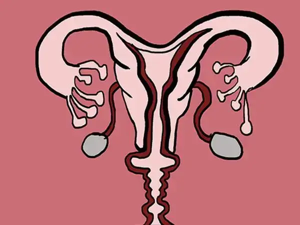 输卵管畸形能不能做试管婴儿