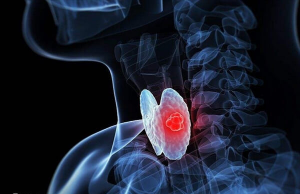 甲状腺结节可不可以做试管婴儿