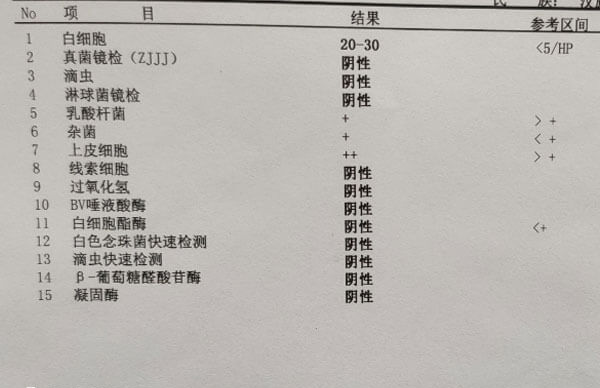 白带常规有哪些检查项目