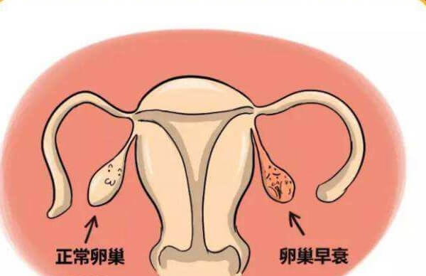 女人卵巢早衰能不能做试管婴儿