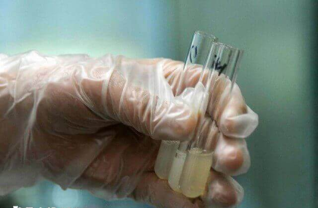 精子不液化怎么怀孕生孩子
