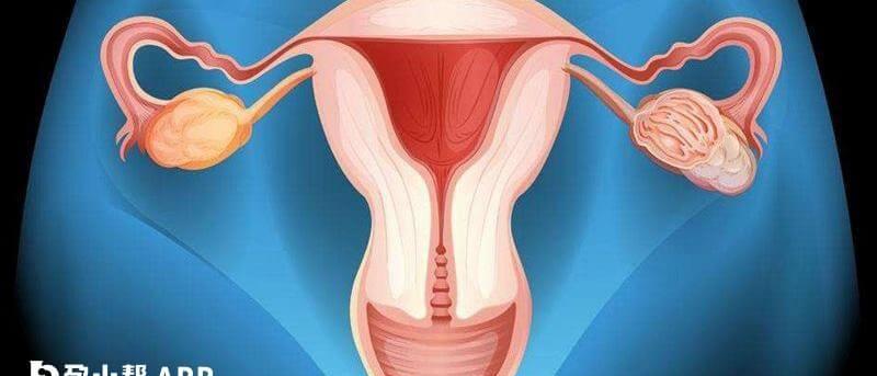 女性27岁单角子宫做试管婴儿成功率