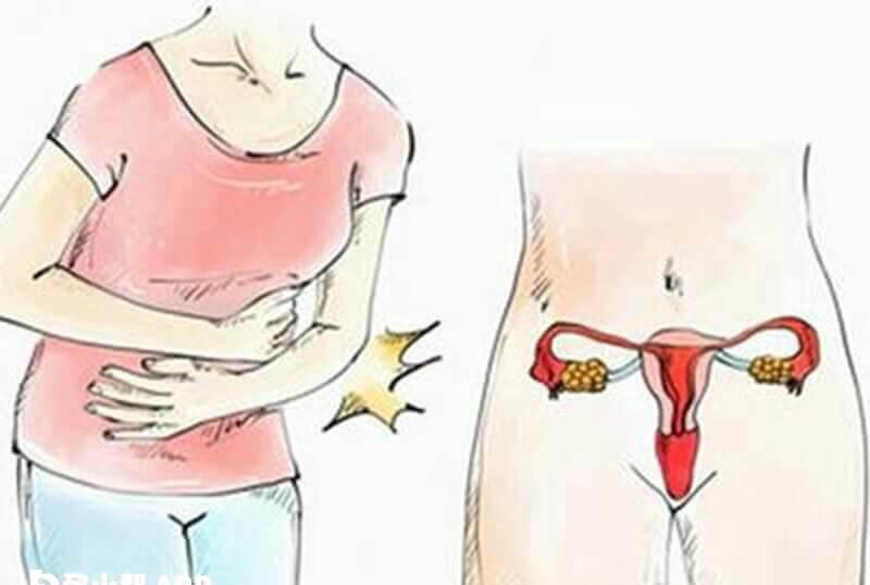患子宫腺肌症想怀孕怎么办