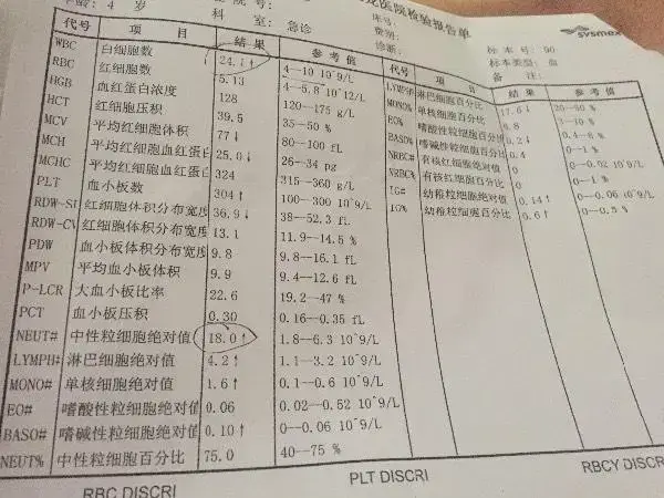 血常规能否查出白血病