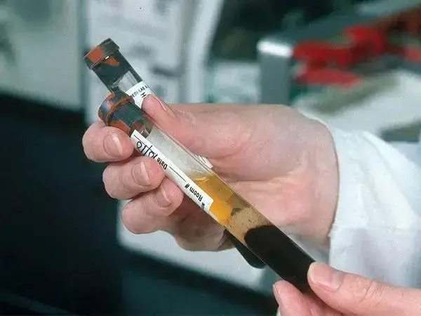 amh0.27做试管婴儿成功率多少