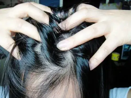 孕早期怀女孩的症状有哪些