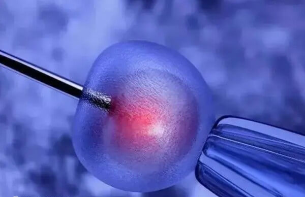 高龄患者做第几代试管易成功
