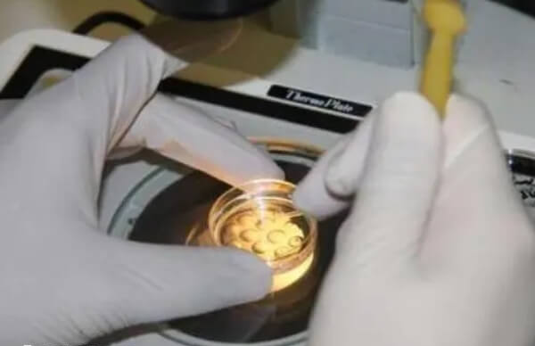 39岁做试管婴儿成功率有多少