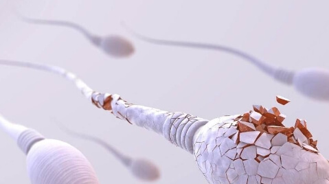 精子DNA碎片率高能不能做二代试管