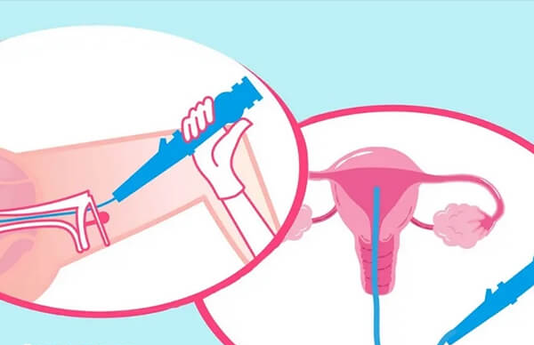 女性做输卵管疏通手术多少钱