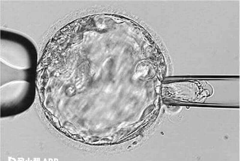 只有较差的2枚4bc囊胚试管成功率有多少