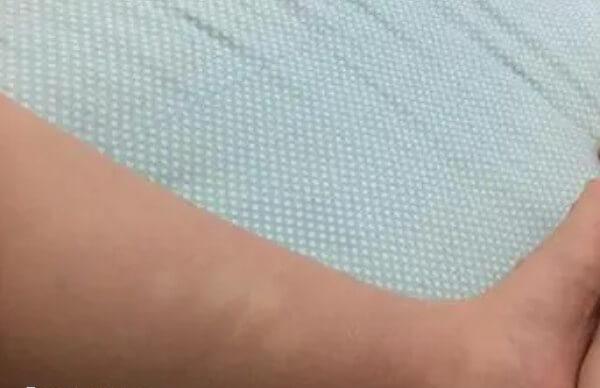 如何避免孕期出现水肿