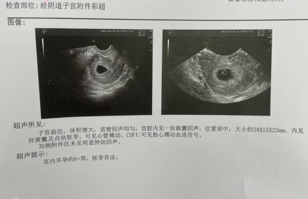 试管移植窗口期怎么检查