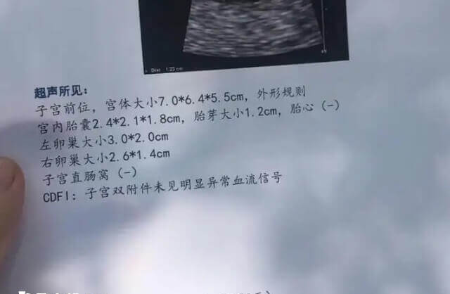 试管移植成功为什么会胎停