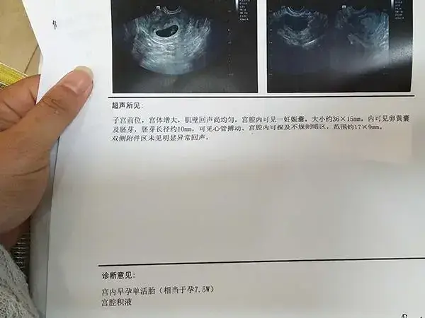 孕酮低于9保胎几率多少