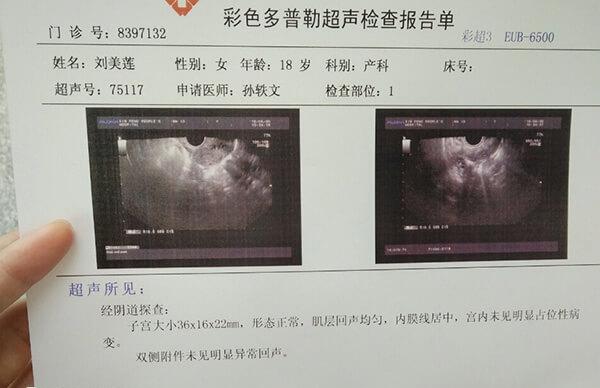 为什么内膜薄不能移植胚胎