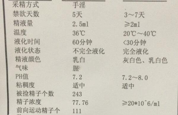 男子精液检查多少钱