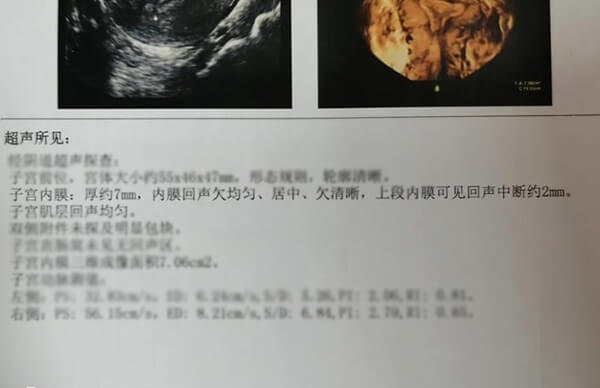 做试管宫腔粘连怎么办