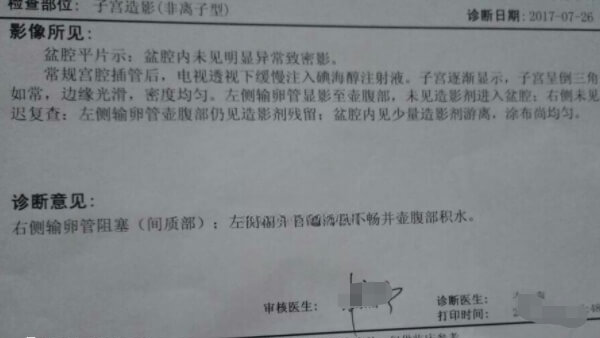 输卵管积水影不影响试管婴儿