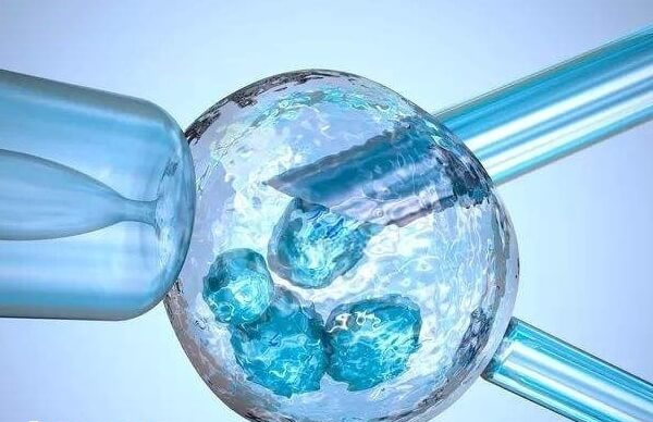试管大龄怀孕为何容易胎儿畸形