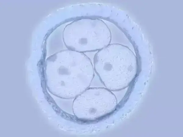 胚胎移植第11天肚子刺疼怎么回事