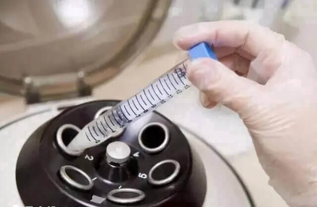 呼和浩特市试管婴儿价格多少