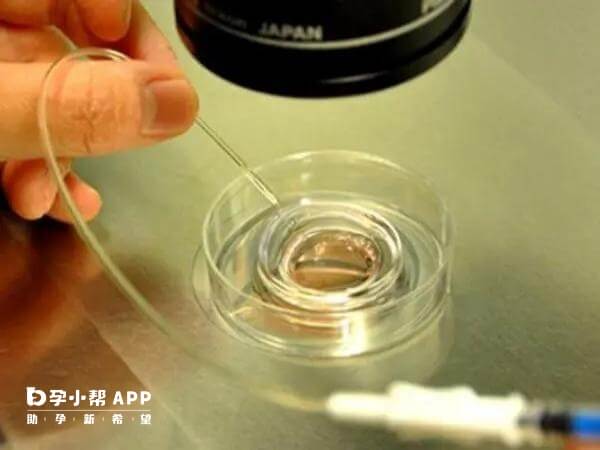 2025年试管婴儿报销多少